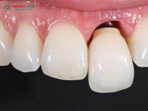 Abc8com cá cược thể thao bị lung lay phải làm sao? Cách xử lý an toàn