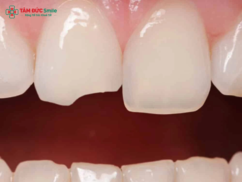 Abc8com cá cược thể thao bị mẻ do đâu? Nguyên nhân, cách khắc phục hiệu quả nhất