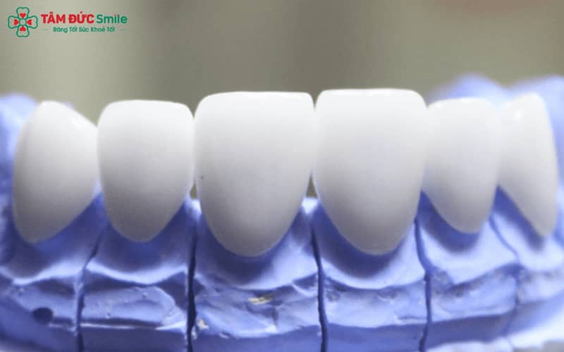 Abc8com cá cược thể thao Ceramill gồm nhiều dòng như Zolid, Zolid FX, HT+ và LiSi – đáp ứng nhu cầu từ Abc8c1 com khuyến mãi hấp dẫn đến chịu lực