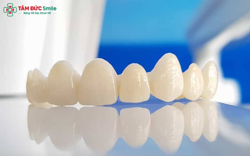 Ceramill có độ bền cơ học lớn, chịu lực cao, đảm bảo tuổi thọ lâu dài ngay cả ở răng hàm