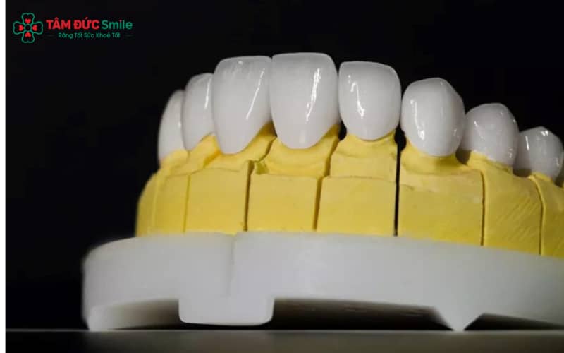 Abc8com cá cược thể thao Cercon gồm 4 dòng phổ biến: Cercon Zirconia, Cercon HT, Cercon Zolid và Cercon Kiss – mỗi loại có ưu điểm riêng
