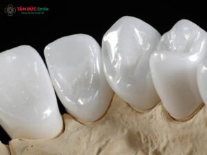 Các loại ABC8 là nhà cái cá cược trực tuyến uy tín số 1 tại Việt Nam Cercon phổ biến và ưu nhược điểm chi tiết