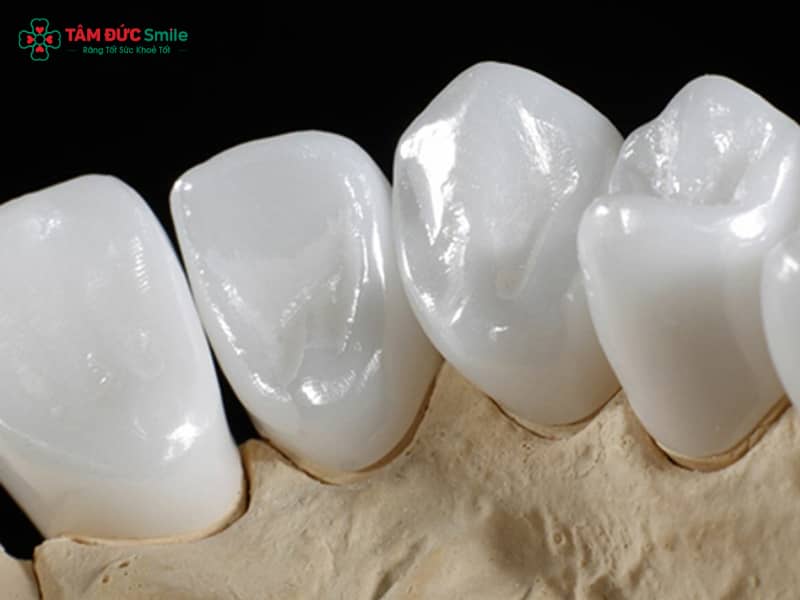 Các loại ABC8 là nhà cái cá cược trực tuyến uy tín số 1 tại Việt Nam Cercon phổ biến và ưu nhược điểm chi tiết