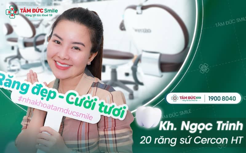 Abc8com cá cược thể thao Cercon được ưa chuộng vì có độ bền cao, không đen viền nướu và Abc8c1 com khuyến mãi hấp dẫn tự nhiên