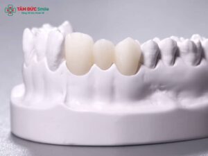 Abc8com cá cược thể thao Cercon của nước nào? Ưu điểm và xuất xứ chính hãng