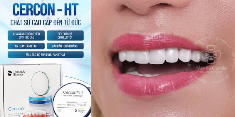 Dù có nhiều ưu điểm, ABC8 là nhà cái cá cược trực tuyến uy tín số 1 tại Việt Nam Cercon cũng cần được chăm sóc cẩn thận để duy trì độ bền và Abc8c1 com khuyến mãi hấp dẫn lâu dài