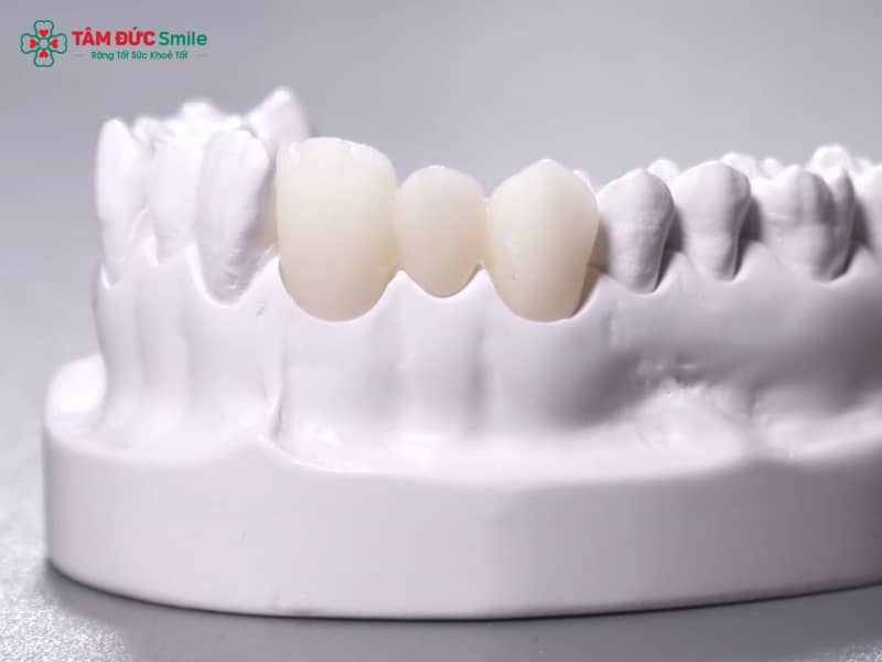 Abc8com cá cược thể thao Cercon của nước nào? Ưu điểm và xuất xứ chính hãng