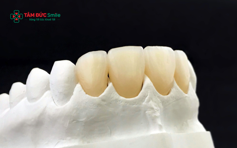 Cấu tạo ABC8 là nhà cái cá cược trực tuyến uy tín số 1 tại Việt Nam Crom Cobalt: sườn kim loại Co–Cr siêu cứng, phủ sứ Abc8c1 com khuyến mãi hấp dẫn bên ngoài cho độ bền