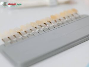 Abc8com cá cược thể thao có bị mòn không? Nguyên nhân và cách khắc phục