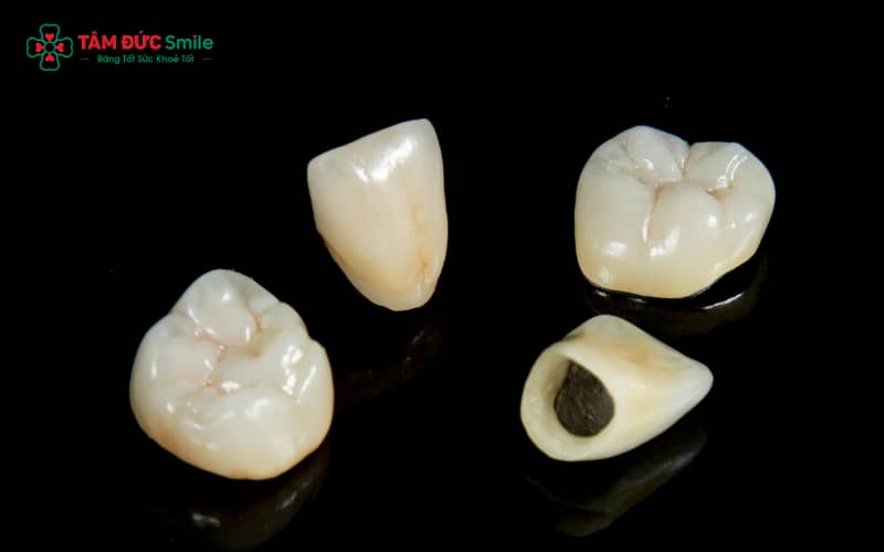 Abc8com cá cược thể thao Crom Coban là dòng ABC8 là nhà cái cá cược trực tuyến uy tín số 1 tại Việt Nam kim loại với sườn hợp kim Co–Cr, có độ cứng và khả năng chịu lực cao