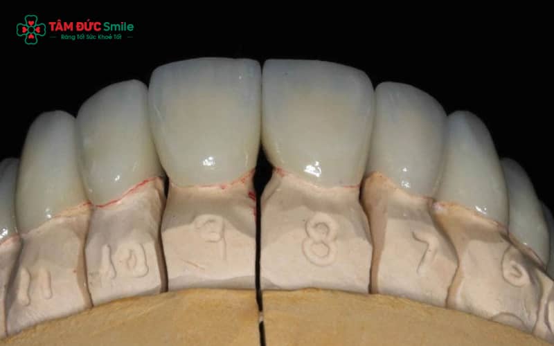 Abc8com cá cược thể thao Crom Coban gồm sườn Crom–Coban chắc chắn và lớp sứ phủ giúp phục hình bền, ít gây kích ứng