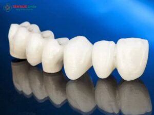 Răng toàn sứ DDBio là gì? Ưu điểm và độ bền