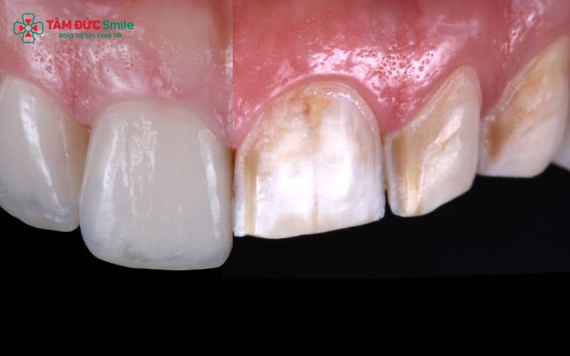 Abc8com cá cược thể thao có tuổi thọ trung bình từ 7–15 năm tùy vào chất lượng và cách chăm sóc