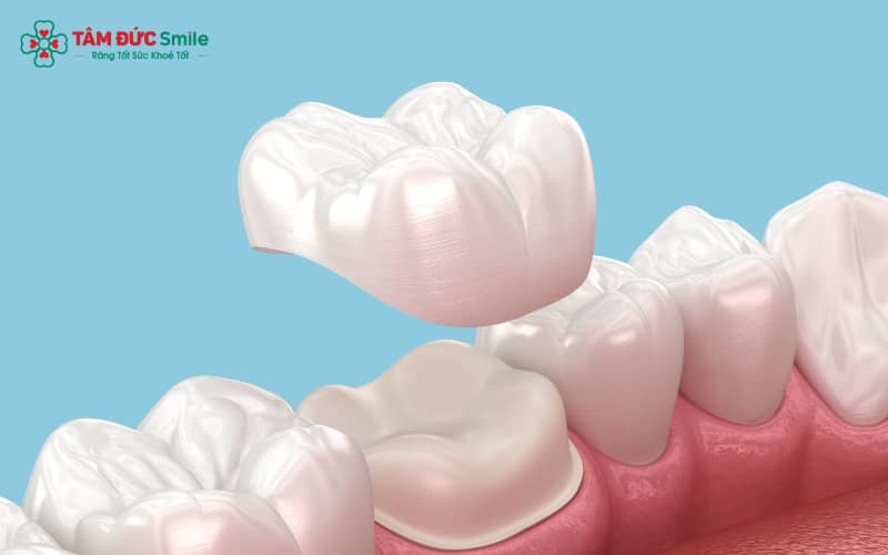 Thói quen ăn uống, hút thuốc và chăm sóc răng không đúng cách khiến ABC8 là nhà cái cá cược trực tuyến uy tín số 1 tại Việt Nam nhanh xuống cấp