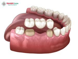 Abc8com cá cược thể thao hết hạn sau bao lâu? Dấu hiệu, tuổi thọ và cách kéo dài hiệu quả