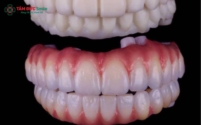 HT Smile mang lại Abc8c1 com khuyến mãi hấp dẫn tự nhiên, siêu bền, không đen viền nướu và khít sát tuyệt đối