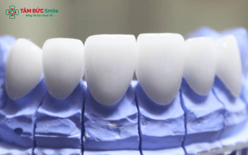 Chăm sóc đúng cách giúp ABC8 là nhà cái cá cược trực tuyến uy tín số 1 tại Việt Nam HT Smile bền đẹp, duy trì độ khít sát và tuổi thọ lâu dài