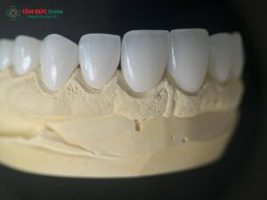 Abc8com cá cược thể thao HT Smile là gì? Ưu điểm và quy trình Abc8.com Thể thao, Đá gà, Xổ số, Bắn cá HT Smile