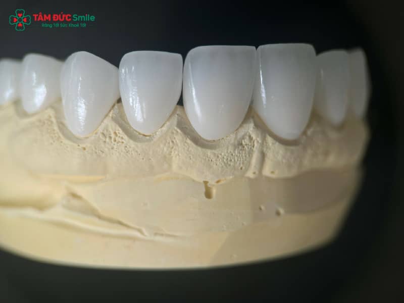 Abc8com cá cược thể thao HT Smile là gì? Ưu điểm và quy trình Abc8.com Thể thao, Đá gà, Xổ số, Bắn cá HT Smile