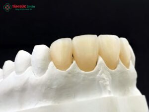 Abc8com cá cược thể thao không kim loại là gì? Ưu điểm và quy trình tại Abc8.com Nhà Cái