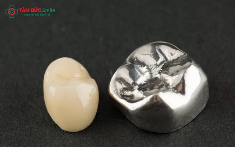 Nhược điểm: có thể đen viền nướu, màu không tự nhiên và dễ gây kích ứng ở người nhạy cảm