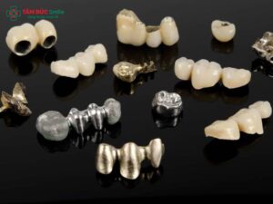 Abc8com cá cược thể thao kim loại Ni-Cr là gì? Cấu tạo, ưu nhược điểm và độ bền