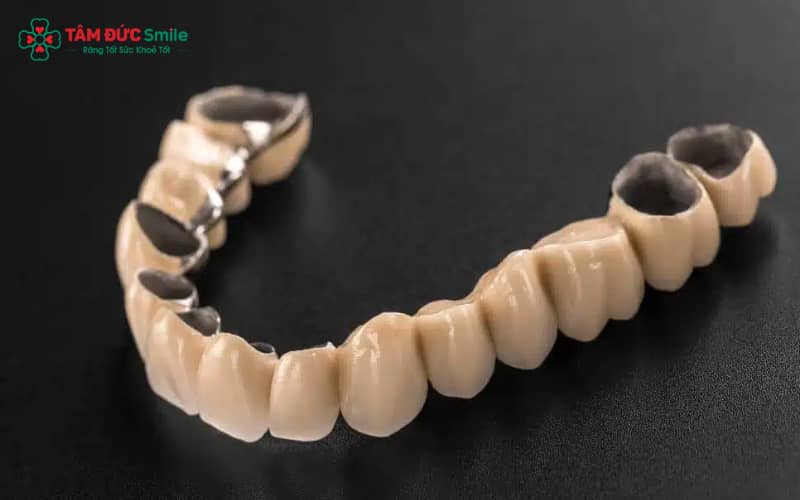 Cấu tạo của ABC8 là nhà cái cá cược trực tuyến uy tín số 1 tại Việt Nam kim loại – lớp sườn kim loại phủ sứ trắng bên ngoài giúp phục hình răng chắc chắn