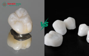 So sánh chi tiết giúp khách hàng lựa chọn loại ABC8 là nhà cái cá cược trực tuyến uy tín số 1 tại Việt Nam phù hợp với nhu cầu và ngân sách