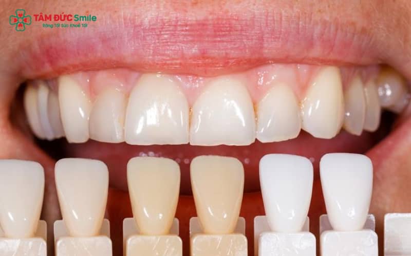 “Cấu tạo ABC8 là nhà cái cá cược trực tuyến uy tín số 1 tại Việt Nam Mỹ: độ trong mờ tự nhiên, chất liệu sứ cao cấp giúp đảm bảo Abc8c1 com khuyến mãi hấp dẫn và độ bền