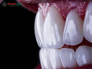 Abc8com cá cược thể thao Mỹ có tốt không? Ưu điểm, độ bền, màu sắc và cấu tạo chi tiết
