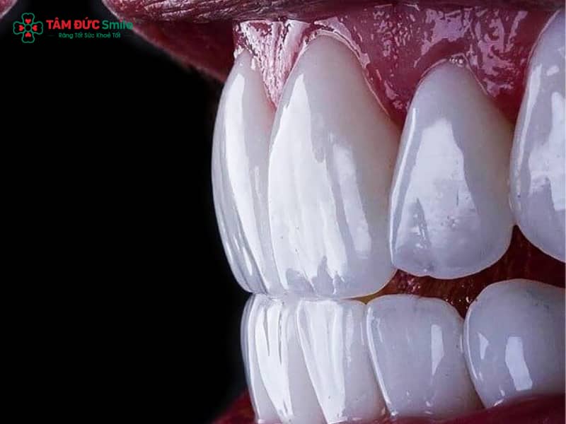 Abc8com cá cược thể thao Mỹ có tốt không? Ưu điểm, độ bền, màu sắc và cấu tạo chi tiết