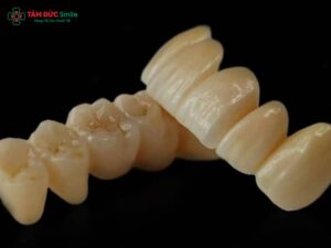 Abc8com cá cược thể thao Nacera Zirconia Đức – Dòng răng toàn sứ cao cấp, bền đẹp tự nhiên