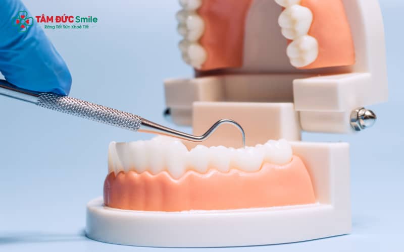 Abc8com cá cược thể thao tháo lắp là dạng phục hình răng có thể tháo ra – lắp vào dễ dàng, giúp khôi phục chức năng ăn nhai và thẩm m