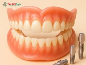 Abc8com cá cược thể thao tháo lắp là gì? Cấu tạo và ưu nhược điểm