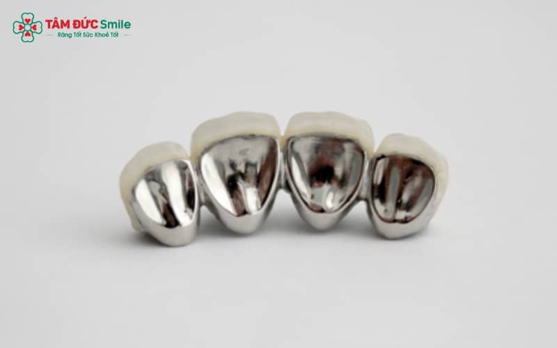 Quy trình Abc8.com Thể thao, Đá gà, Xổ số, Bắn cá Titan tại Abc8.com Nhà Cái: khám – mài răng – lấy dấu 3D – chế tác – gắn thử – cố định hoàn thiện