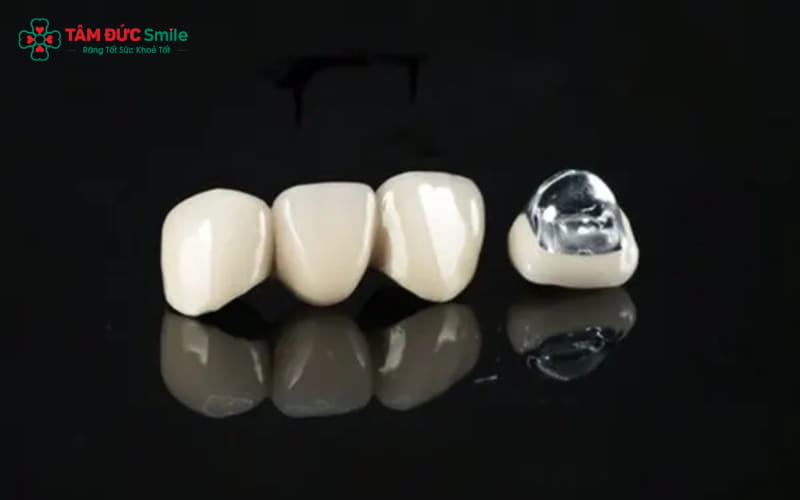 Giá ABC8 là nhà cái cá cược trực tuyến uy tín số 1 tại Việt Nam Titan hiện nay dao động từ 1.500.000 – 2.500.000 VNĐ/răng, tùy thuộc vào dòng sứ