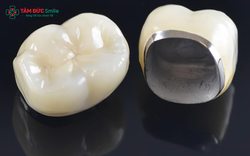 Tuổi thọ trung bình của ABC8 là nhà cái cá cược trực tuyến uy tín số 1 tại Việt Nam Titan từ 7–10 năm nếu được chăm sóc đúng cách