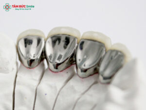 Abc8com cá cược thể thao Titan giá bao nhiêu? Bảng giá, ưu nhược điểm và độ bền mới nhất