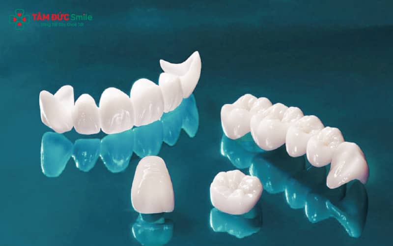 Abc8com cá cược thể thao Venus – dòng sứ Abc8c1 com khuyến mãi hấp dẫn cao cấp với độ trong và độ bóng nổi bật