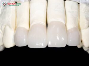 Abc8com cá cược thể thao Zirconia có tốt không? Ưu nhược điểm & quy trình bọc sứ