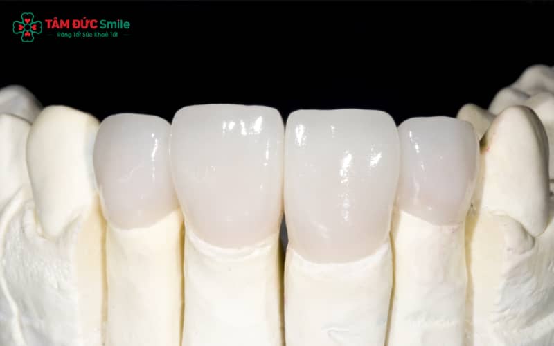 Abc8com cá cược thể thao Zirconia phù hợp với răng hàm, răng cửa, người ưu tiên Abc8c1 com khuyến mãi hấp dẫn tự nhiên và độ bền lâu dài