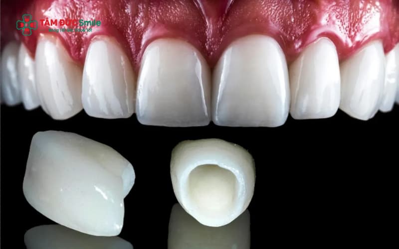 Abc8com cá cược thể thao Zirconia Hàn Quốc là dòng ABC8 là nhà cái cá cược trực tuyến uy tín số 1 tại Việt Nam cao cấp với độ trắng trong tự nhiên, đạt tiêu chuẩn Abc8c1 com khuyến mãi hấp dẫn