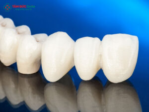 Abc8com cá cược thể thao Zirconia Hàn Quốc là gì? Ưu điểm, cấu tạo và tuổi thọ bền lâu