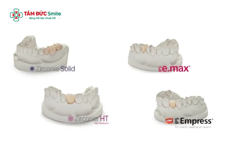 Các loại răng toàn sứ phổ biến gồm Zirconia, Cercon, Emax Press, Nacera và nhiều dòng cao cấp khác