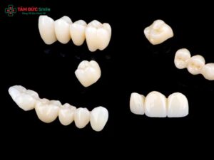 Răng toàn sứ có mấy loại? So sánh Zirconia, Cercon, Nacera, Emax đẹp bền