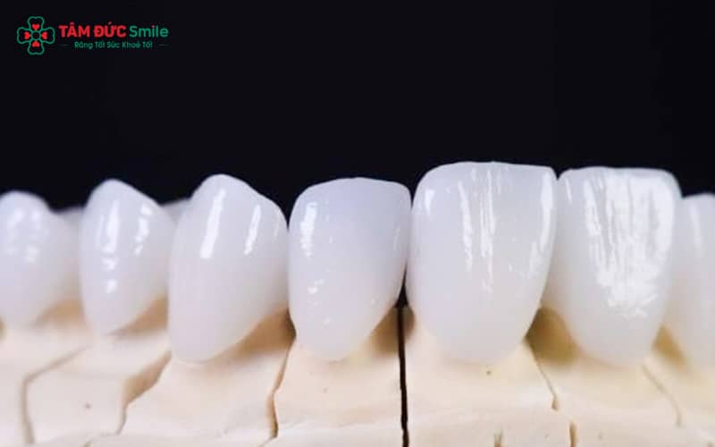 Abc8com cá cược thể thao Venus có độ bền cao, chịu lực tốt, đảm bảo sử dụng lâu dài nếu chăm sóc đúng cách
