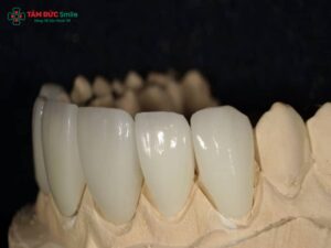 Abc8com cá cược thể thao Venus là gì? Ưu điểm, độ bền và cảm nhận sau khi bọc