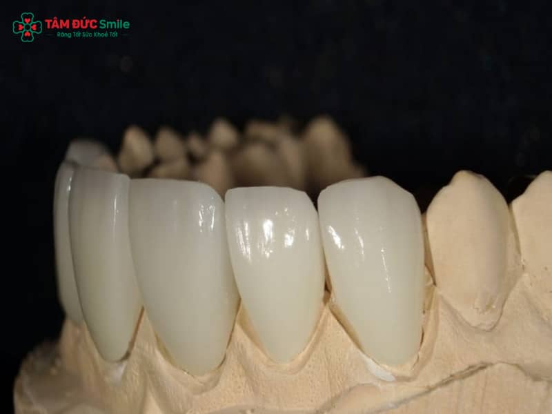Abc8com cá cược thể thao Venus là gì? Ưu điểm, độ bền và cảm nhận sau khi bọc