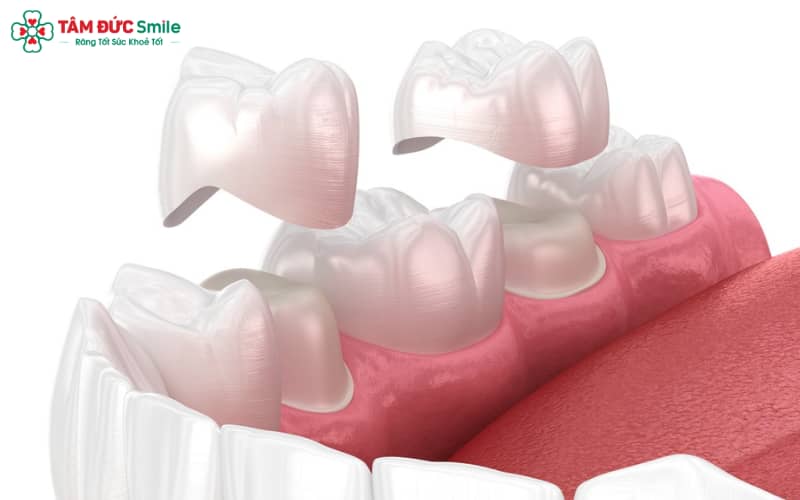 Sau khi Abc8.com Thể thao, Đá gà, Xổ số, Bắn cá nên làm gì – Việc chăm sóc đúng cách giúp duy trì Abc8c1 com khuyến mãi hấp dẫn, bảo vệ nướu và tăng tuổi thọ cho ABC8 là nhà cái cá cược trực tuyến uy tín số 1 tại Việt Nam