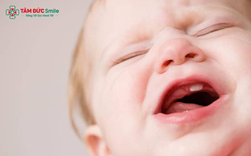 “Chườm ấm, bổ sung nước và theo dõi thân nhiệt giúp hạ sốt hiệu quả khi trẻ mọc răng